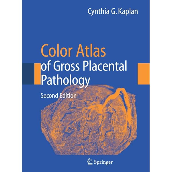 Color Atlas of Microneurosurgery of … Color Atlas of Microneurosurgery: 9783131111029: Medicine & Health